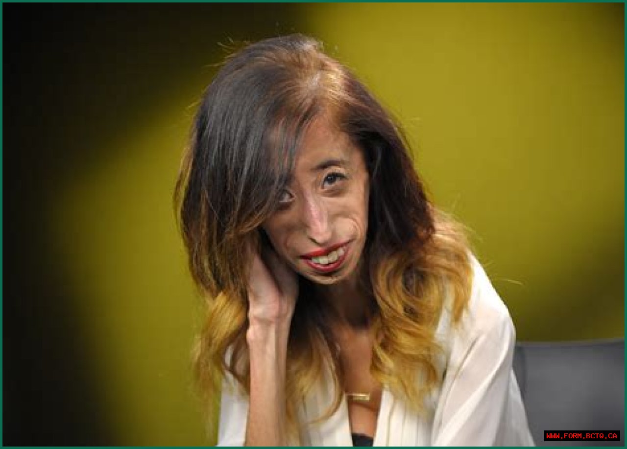 The Surprising Truth About Being Dubbed The Ugliest Person In The World